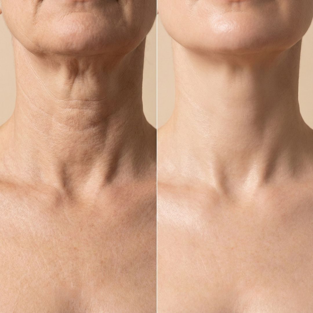 Axi-Lift™ Tighten & Lift Neck Cream