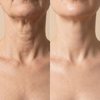Axi-Lift™ Tighten & Lift Neck Cream