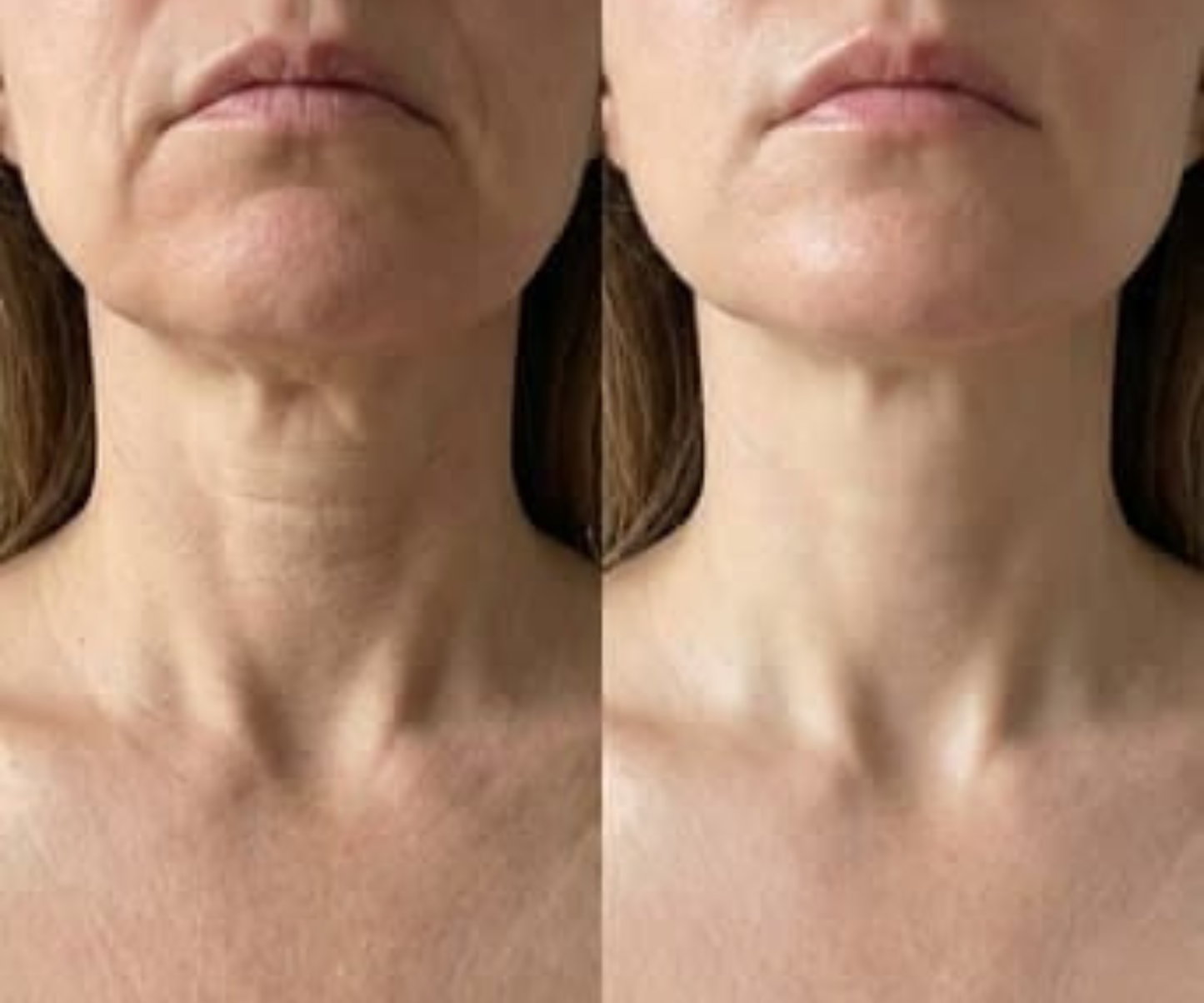 Axi-Lift™ Tighten & Lift Neck Cream