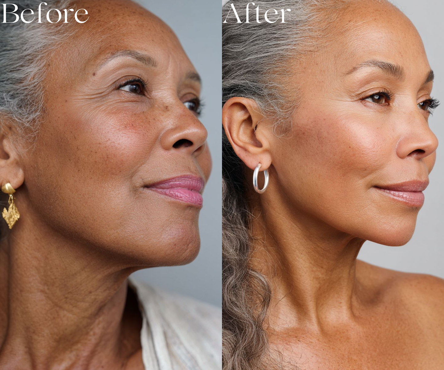 Axi-Lift™ Tighten & Lift Neck Cream